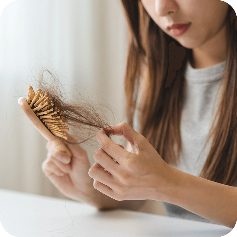 Women-hair-loss